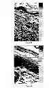 Fig. 03 - METHODS AND COMPOSITIONS FOR MAINTAINING AND IMPROVING THE HEALTH OF SKIN