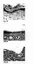 Fig. 06 - METHODS AND COMPOSITIONS FOR MAINTAINING AND IMPROVING THE HEALTH OF SKIN