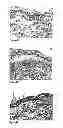 Fig. 07 - METHODS AND COMPOSITIONS FOR MAINTAINING AND IMPROVING THE HEALTH OF SKIN