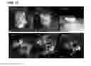 Fig. 10 - CORE-SHELL NANOPARTICULATE COMPOSITIONS AND METHODS