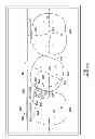 Fig. 02 - Sequential modules for computer aided bracketing systems and associated methods and devices