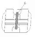 Fig. 01 - BRACKET FOR CORRECTING DENTOGNATHIC DEFORMITY