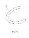 Fig. 04 - BRACKET FOR CORRECTING DENTOGNATHIC DEFORMITY