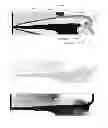 Fig. 04 - Device and method for secondary dental caries diagnosis