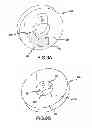 Fig. 15 - Interdental cleaner using water supply