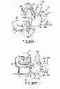 Fig. 37 - Interdental cleaner using water supply