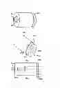 Fig. 03 - Abutment for Implant