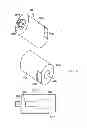 Fig. 04 - Abutment for Implant