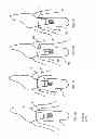 Fig. 04 - Dental implant