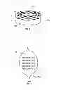 Fig. 03 - Self-exploration therapeutic assembly and method