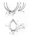 Fig. 04 - Self-exploration therapeutic assembly and method