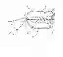 Fig. 04 - INTRA-ORAL ANATOMY TRAINING DEVICE