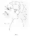 Fig. 05 - INTRA-ORAL ANATOMY TRAINING DEVICE