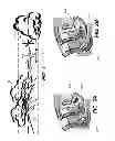 Fig. 02 - Methods and apparatus for reducing anxiety during travel