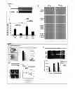 Fig. 04 - Genes causing hereditary kidney disease or malformation of the urinary tract