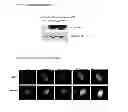 Fig. 07 - Genes causing hereditary kidney disease or malformation of the urinary tract