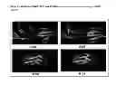 Fig. 11 - Genes causing hereditary kidney disease or malformation of the urinary tract