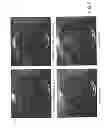 Fig. 07 - ACTIVATION AND AGGREGATION OF HUMAN PLATELETS AND FORMATION OF PLATELET GELS BY NANOSECOND PULSED ELECTRIC FIELDS