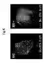 Fig. 07 - CELL MASS CAPABLE OF SERVING AS A PRIMITIVE ORGAN-LIKE STRUCTURE COMPRISED OF A PLURALITY OF CELL TYPES OF SOMATIC ORIGIN