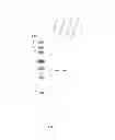 Fig. 07 - RNase H-based assays utilizing modified RNA monomers