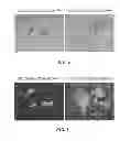Fig. 06 - METHODS AND COMPOSITIONS FOR LONG TERM HEMATOPOIETIC REPOPULATION