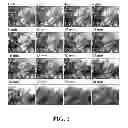 Fig. 02 - Intra-culture perfusion methods and applications thereof