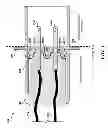 Fig. 04 - Non-conductive material with peaks and valleys surrounding a plurality of electrical contacts