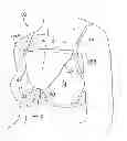 Fig. 01 - Attachable Brassier Pocket