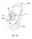 Fig. 22 - Multiple input acoustic coupler