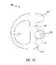 Fig. 41 - Multiple input acoustic coupler