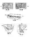 Fig. 08 - System and method for gathering and analyzing objective motion data