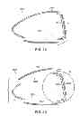 Fig. 14 - Golf club head having a multi-material face