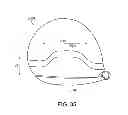 Fig. 19 - Golf club head having a multi-material face