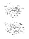 Fig. 06 - Golf club head