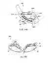 Fig. 10 - Golf club head