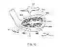 Fig. 13 - Golf club head