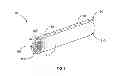 Fig. 02 - METHODS AND SYSTEMS FOR SECURING A SLEEVE FOR ENDOLUMINAL DEVICES