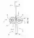 Fig. 07 - METHODS AND SYSTEMS FOR SECURING A SLEEVE FOR ENDOLUMINAL DEVICES