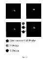 Fig. 15 - Fetal aneuploidy detection by sequencing