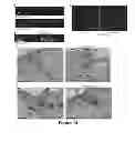 Fig. 15 - Methods and systems for adenovirus interaction with desmoglein 2 (DSG2)