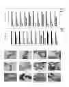 Fig. 10 - PHARAMACEUTICAL COMPOSITION FOR PREVENTING OR TREATING HUMAN IMMUNODEFICIENCY VIRUS