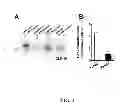 Fig. 03 - METHODS AND COMPOSITIONS FOR PREDICTING RESPONSE TO GLP-1 ANALOGS