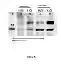 Fig. 06 - METHODS AND COMPOSITIONS FOR PREDICTING RESPONSE TO GLP-1 ANALOGS
