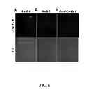 Fig. 07 - METHODS AND COMPOSITIONS FOR PREDICTING RESPONSE TO GLP-1 ANALOGS