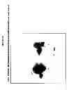 Fig. 19 - Methods and Apparatus for Creating Particle Derivatives of HDL with Reduced Lipid Content