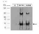 Fig. 04 - Production and delivery of a stable collagen