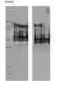 Fig. 05 - Production and delivery of a stable collagen