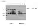 Fig. 06 - Production and delivery of a stable collagen
