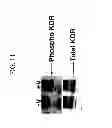 Fig. 13 - KDR and VEGF/KDR binding peptides and their use in diagnosis and therapy