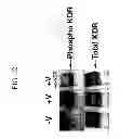 Fig. 14 - KDR and VEGF/KDR binding peptides and their use in diagnosis and therapy